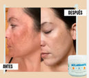 Crema Aclaradora Corporal
