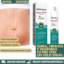 South Moon | Spray Elimina Cicatrices en semanas